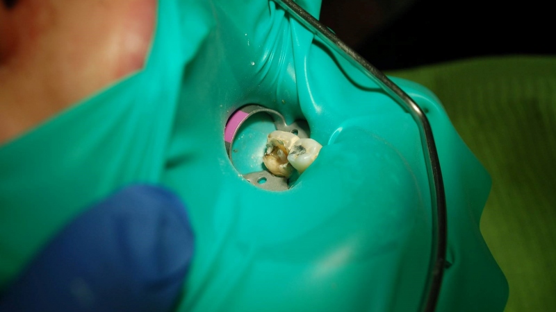 Výplne zhotovené sklenenými vláknami Výplne zhotovené sklenenými vláknami