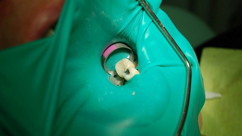 Výplne zhotovené sklenenými vláknami Výplne zhotovené sklenenými vláknami