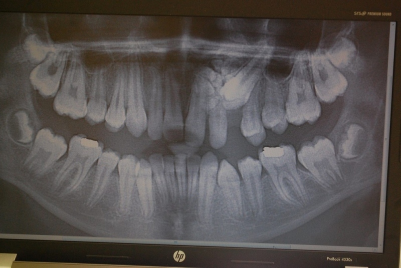 Chirurgia detí a dorastu - rentgen Chirurgia detí a dorastu - rentgen