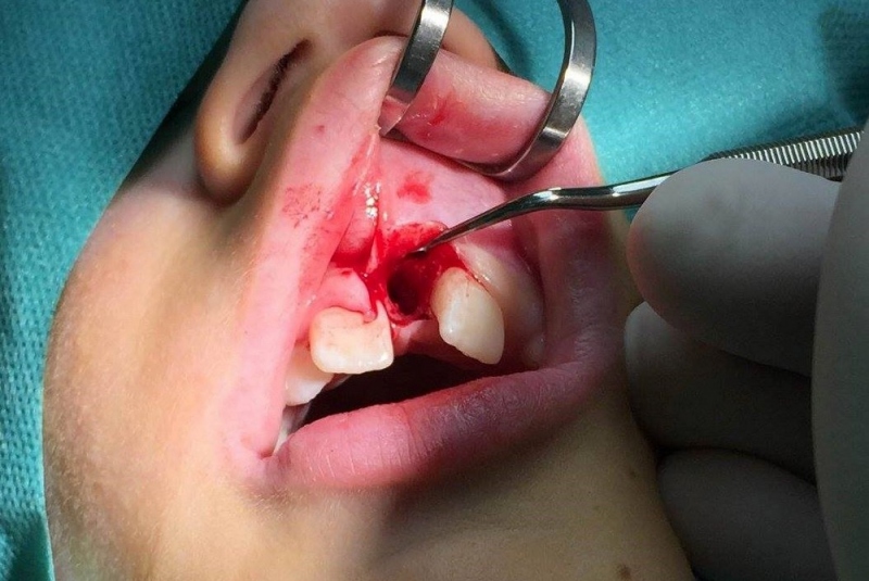 Chirurgia detí a dorastu Chirurgia detí a dorastu