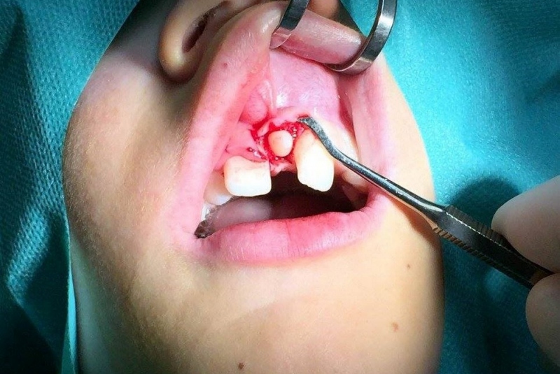 Chirurgia detí a dorastu Chirurgia detí a dorastu