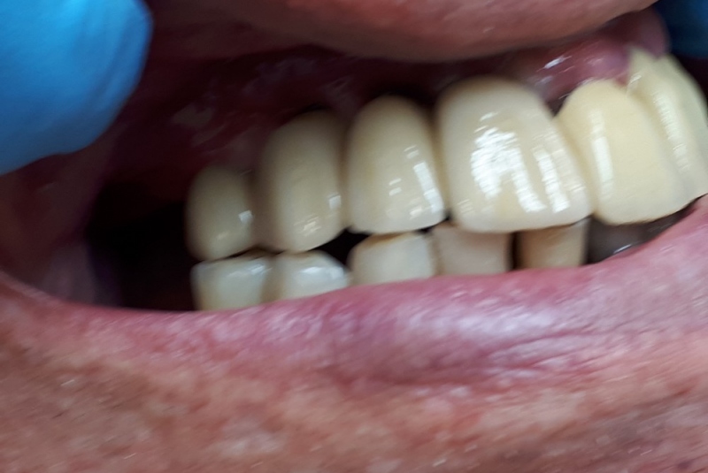 Implantológia, vrátane 3D Implantológia, vrátane 3D